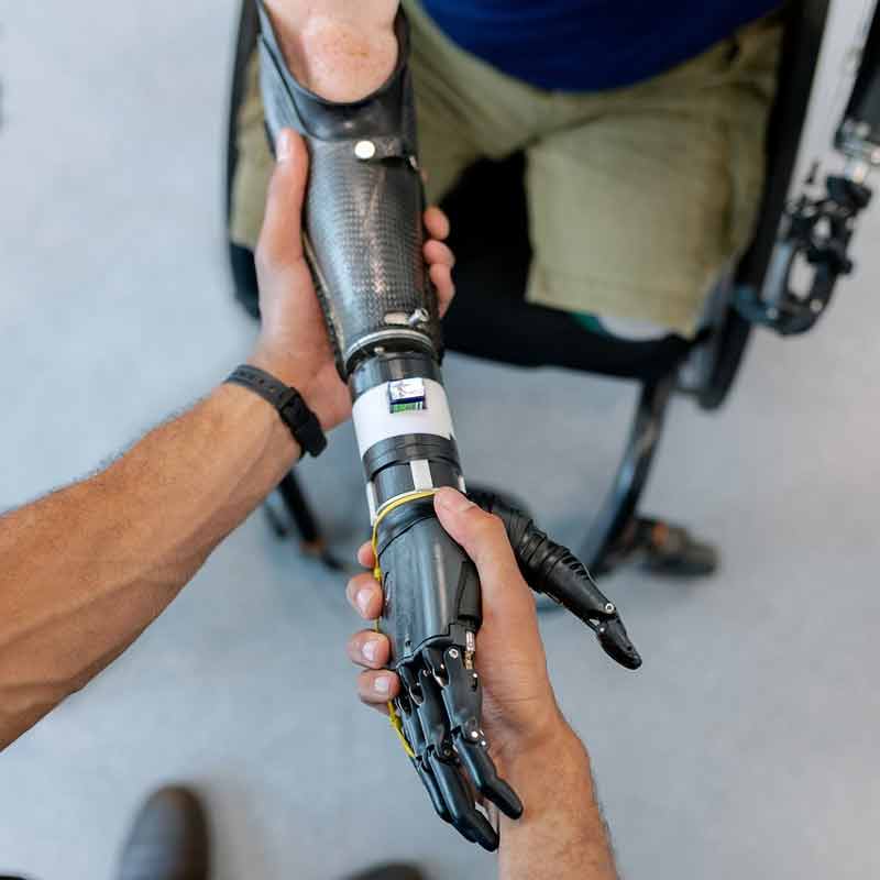 Magnets and the future of prosthetic limbs
